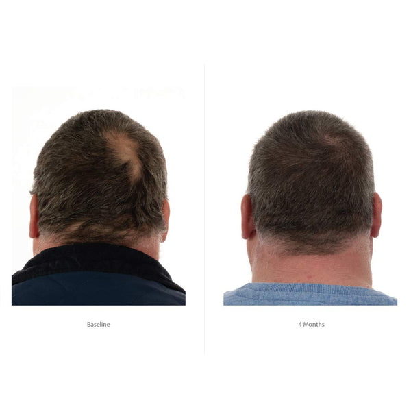 Ensemble d'essai FOLIGAIN Triple Action Hair Care System pour hommes en 3 pièces